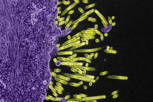 Swine flue particles